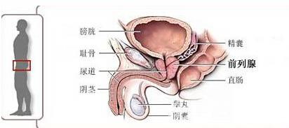 慢性附睾炎的危害